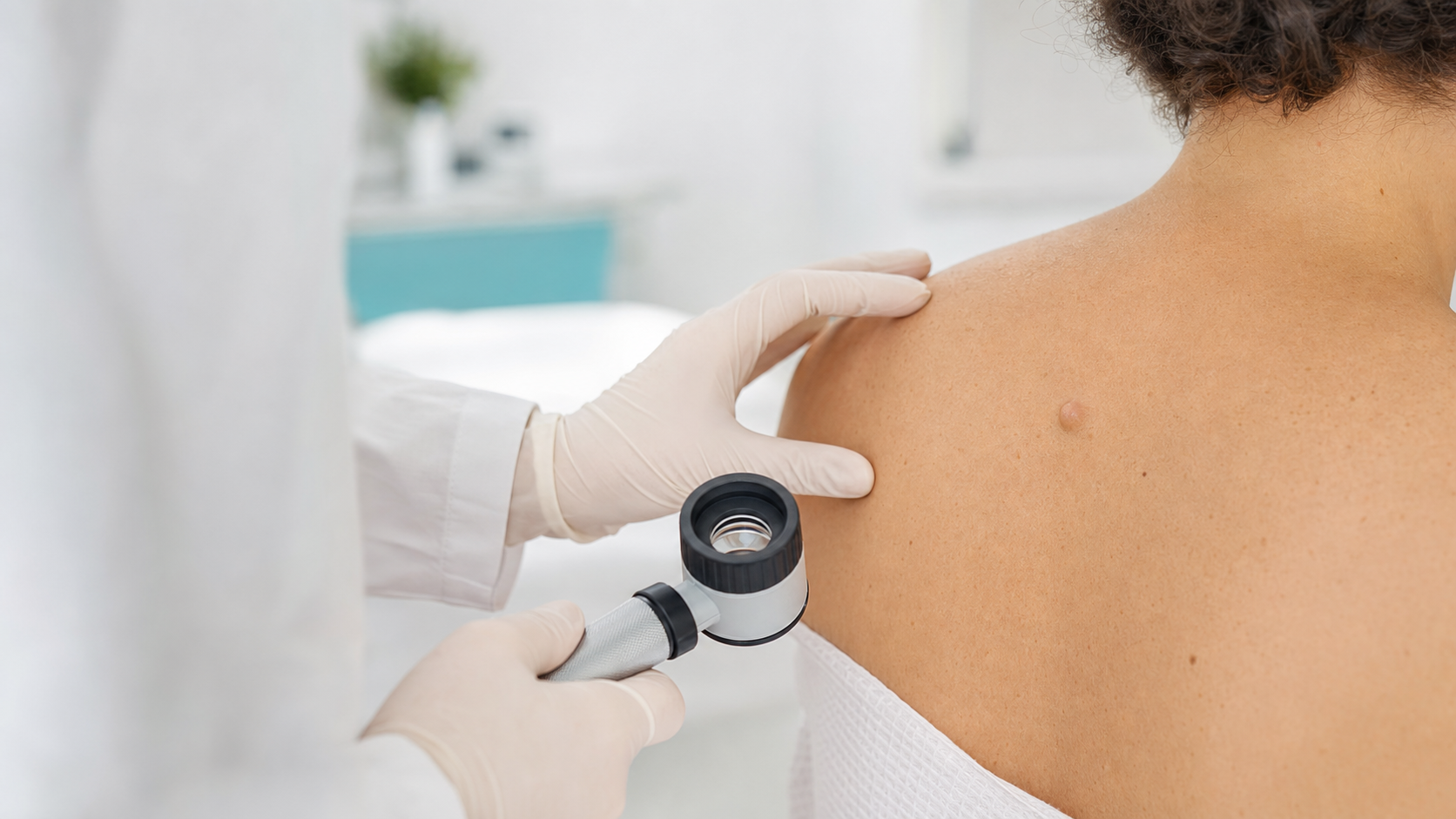 A benign keratin-filled cyst under the skin that may have a central punctum and can become inflamed,