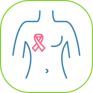 Newly diagnosed ER+ HER2- breast cancer
