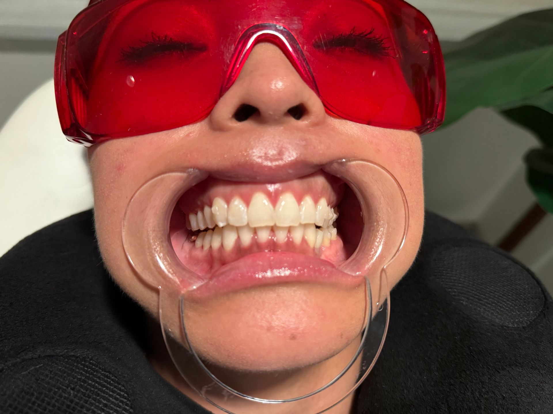 A close up of a person 's mouth with white teeth.