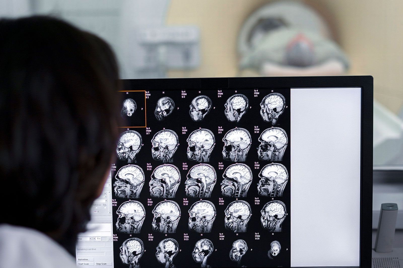 Tudo o que você precisa saber para perder o medo da Tomografia Computadorizada