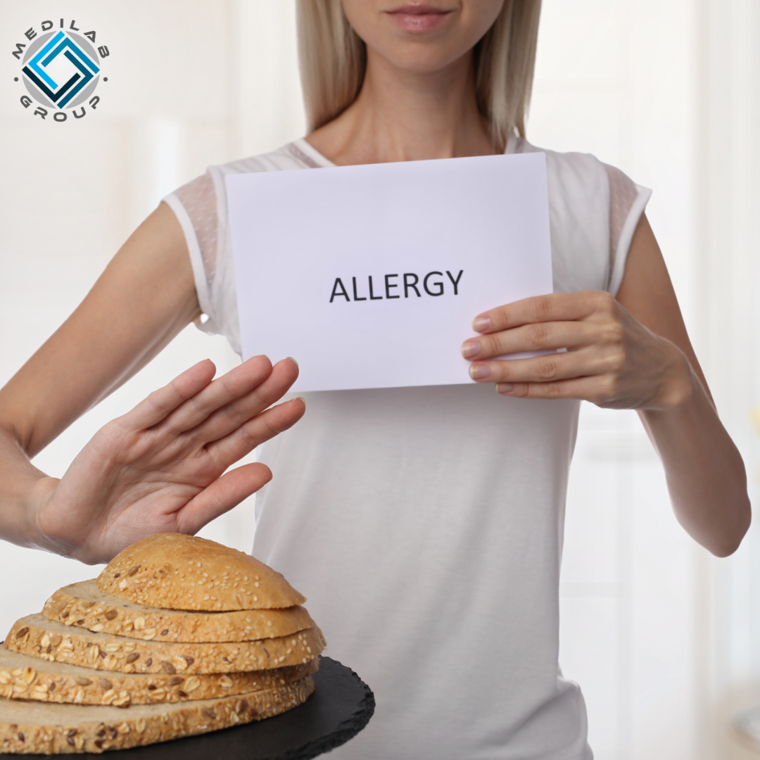 Intolleranze Alimentari