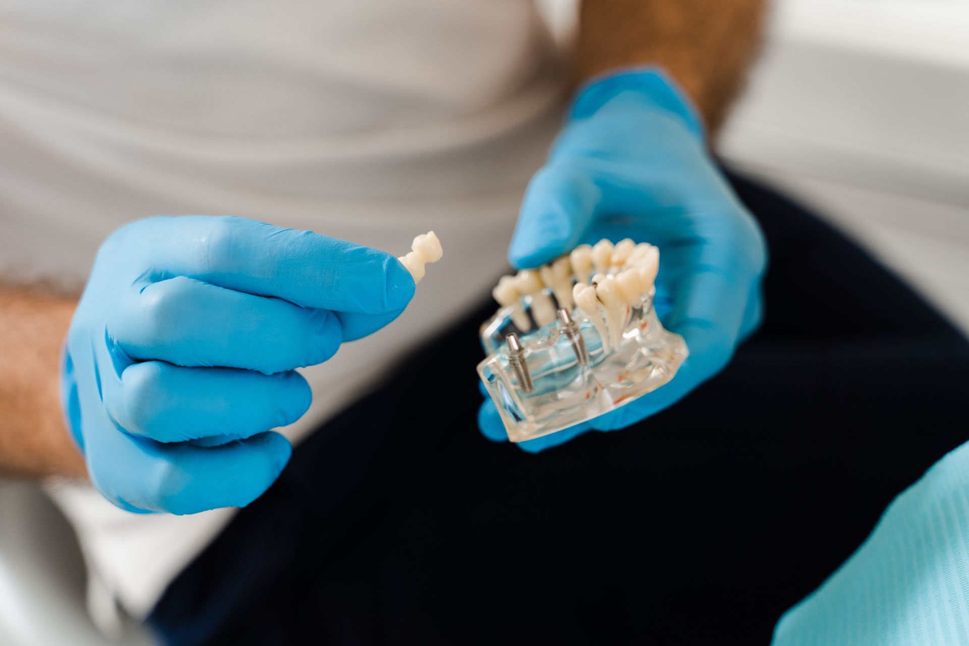 A dental professional in blue nitrile gloves holds a dental implant model and a prosthetic tooth.