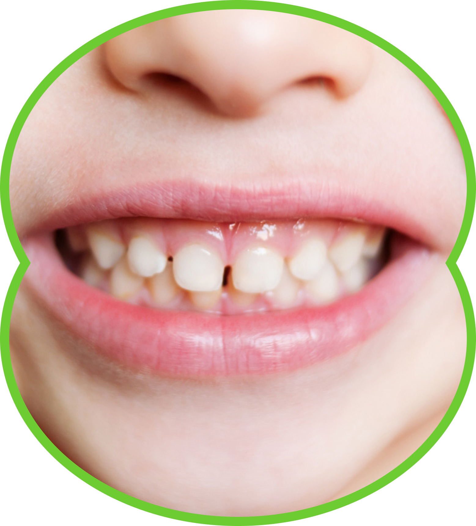 Woman pulling down lower lip, showing red gums and white teeth.