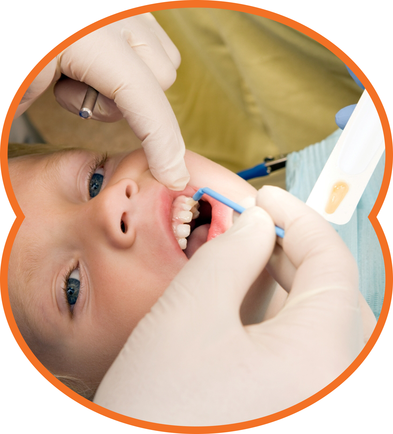Child in a dentist's chair, mouth open, receiving dental work; blue setting.