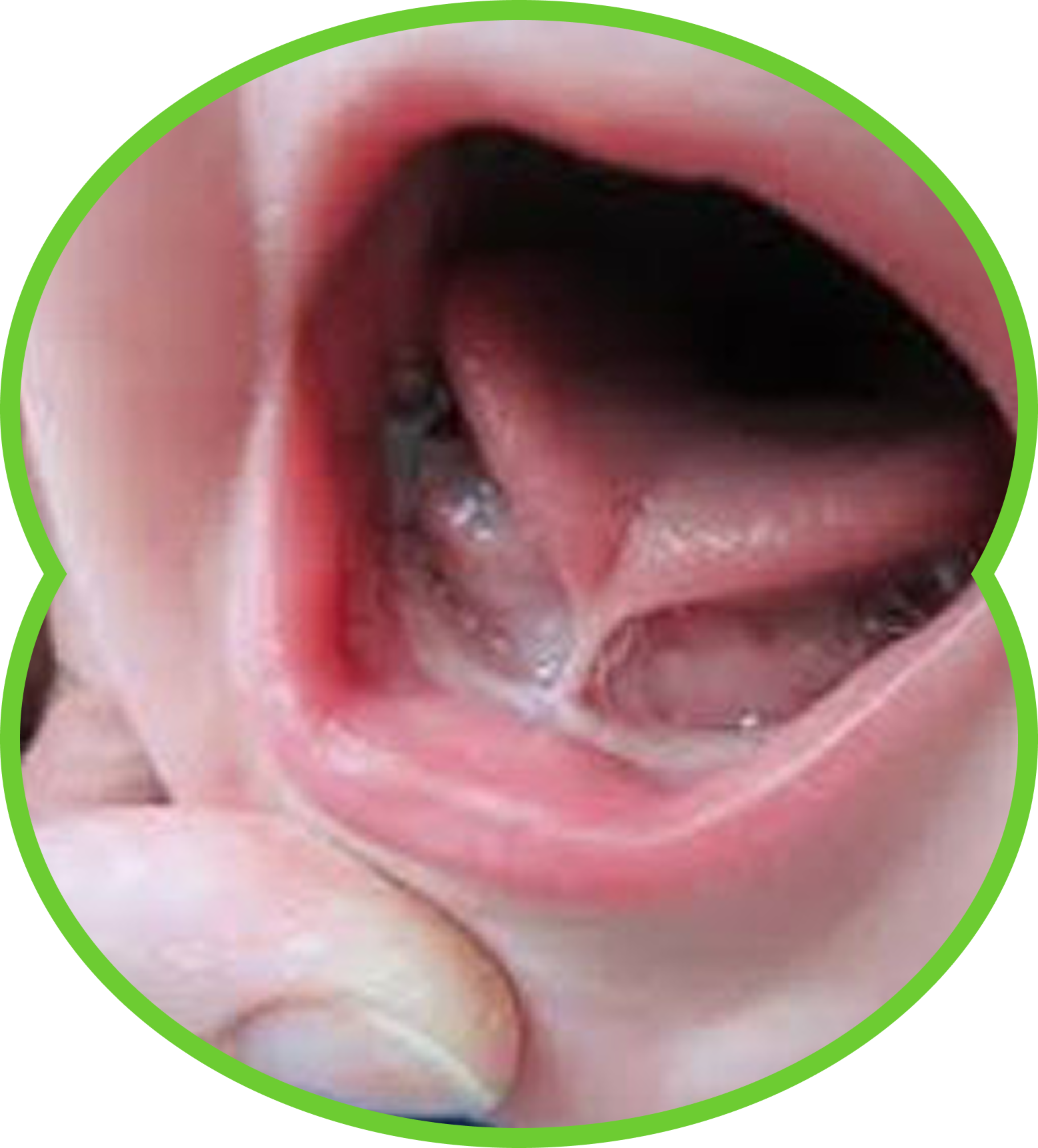 Woman pulling down lower lip, showing red gums and white teeth.