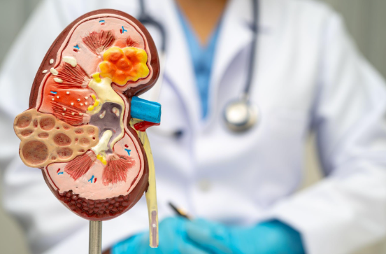 How Hydration Supports Kidney Health and Helps You Stay Cool in the Summer Heat | Metropolitan Kidney Centers
