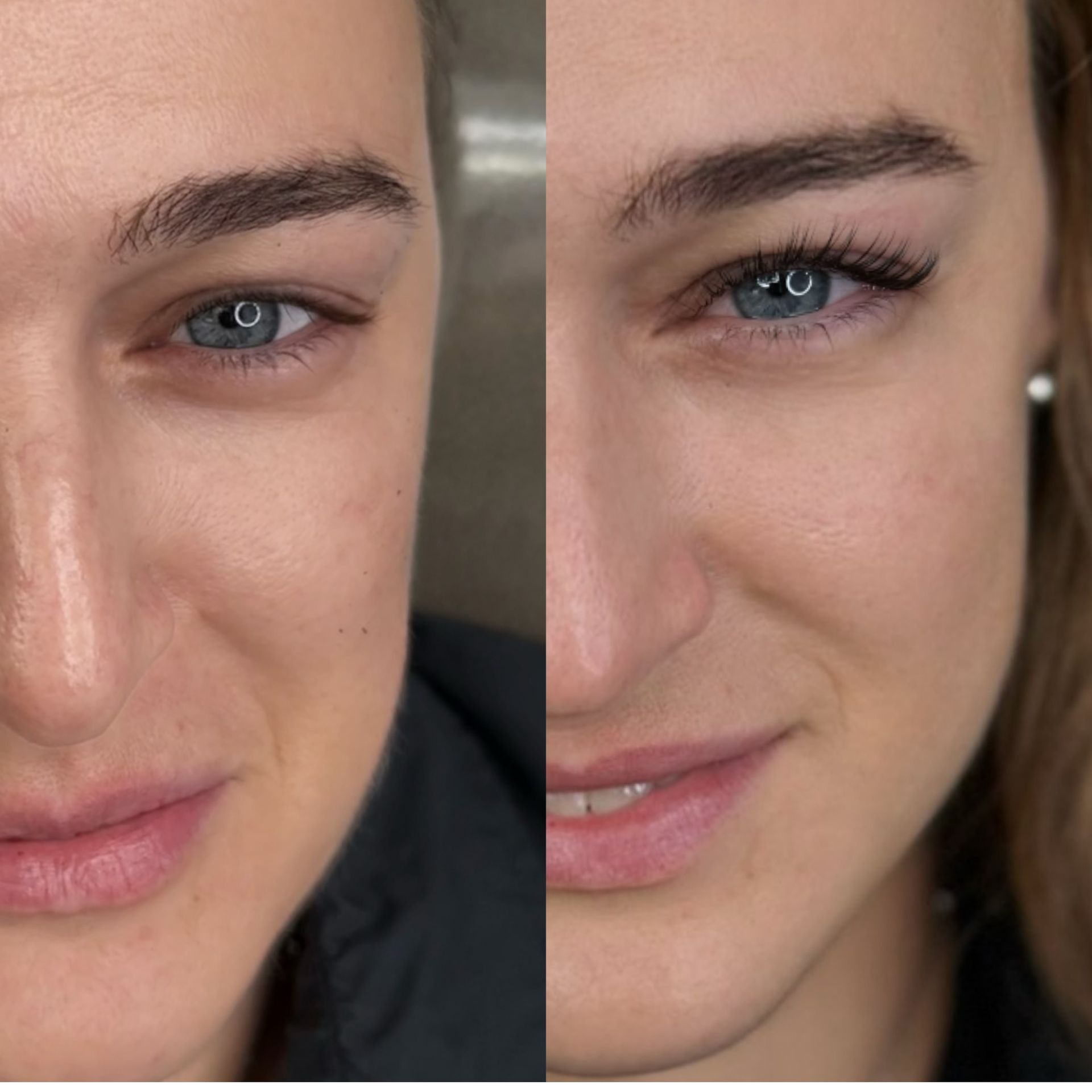 A before and after picture of a woman 's face