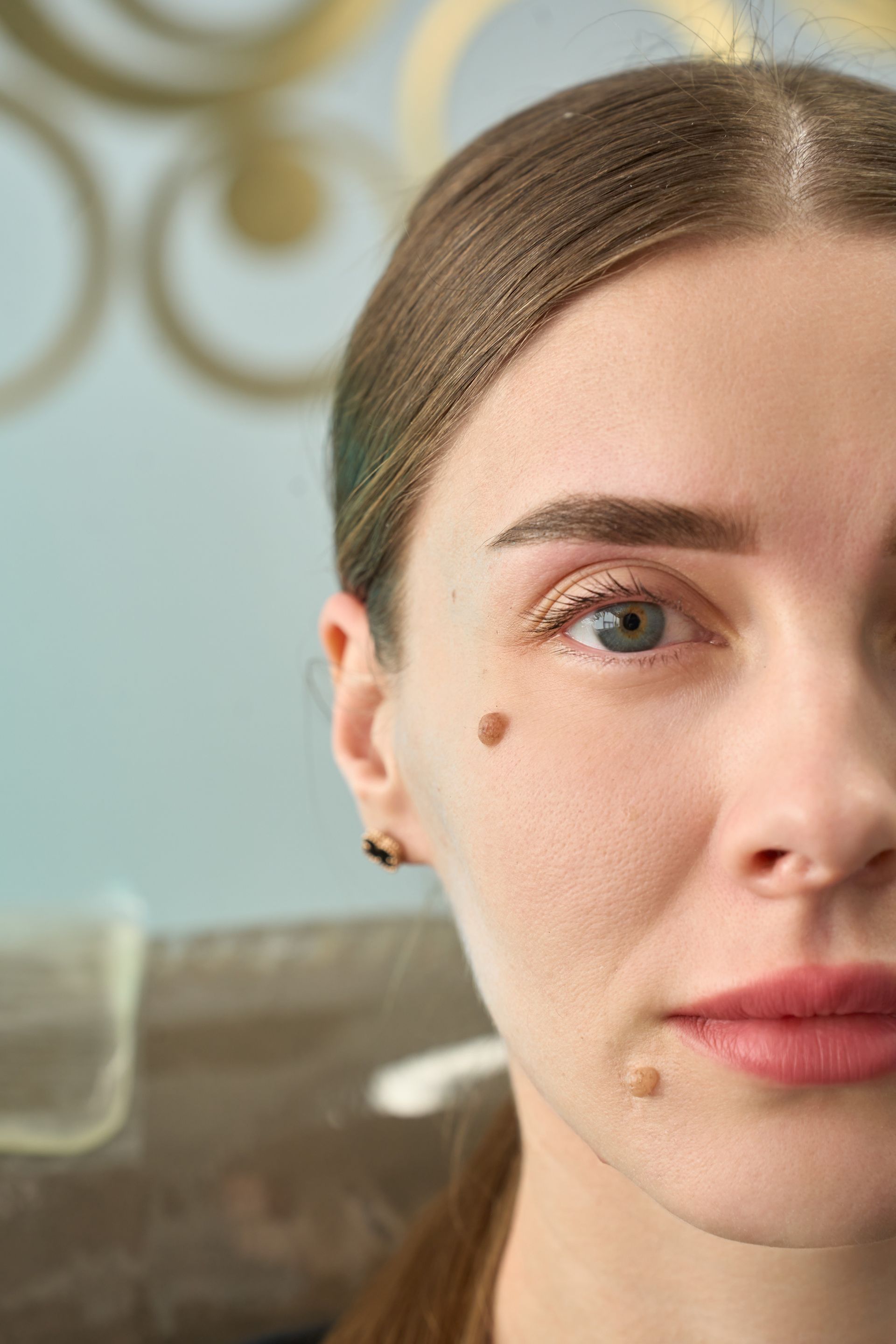A close up of a woman 's face with a mole on her forehead.