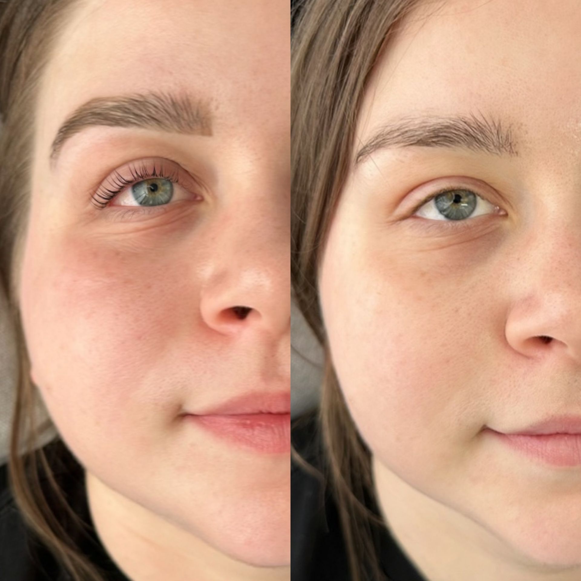 A before and after picture of a woman 's face.