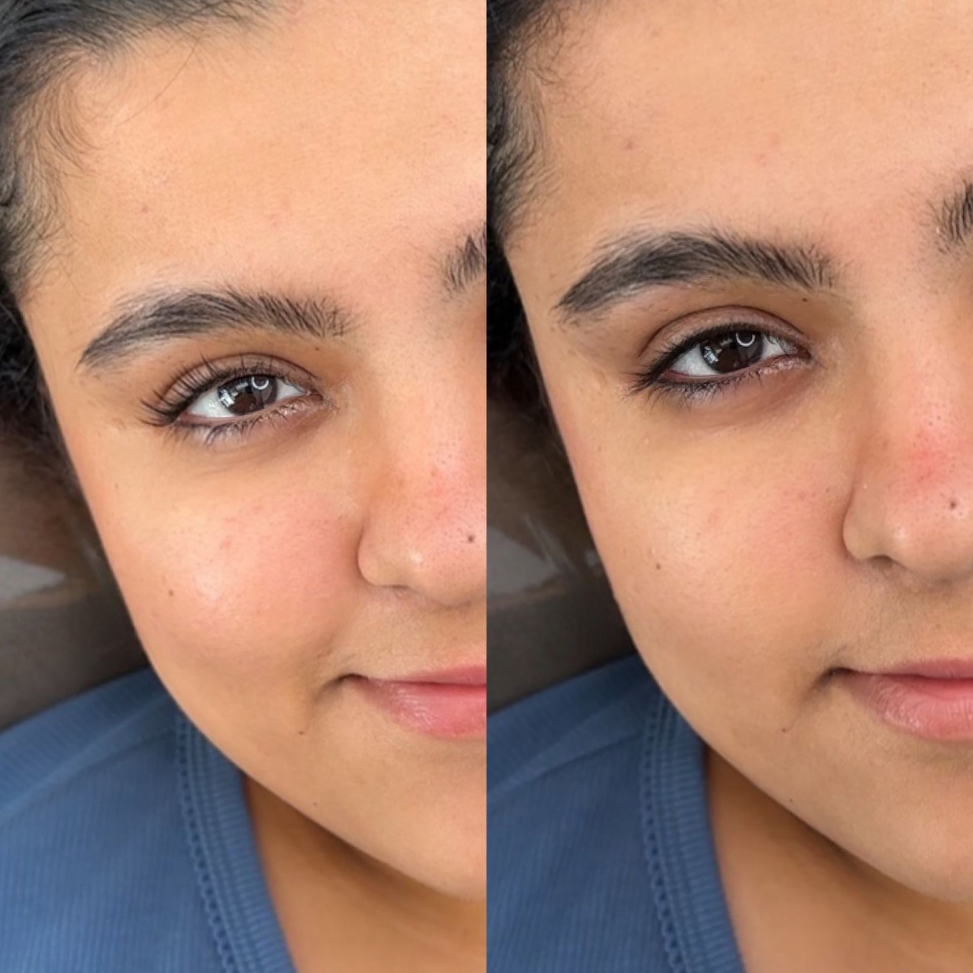 A before and after picture of a woman 's face