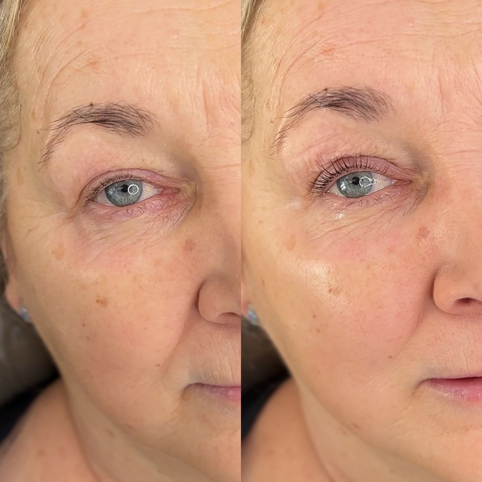 A before and after photo of a woman 's face.