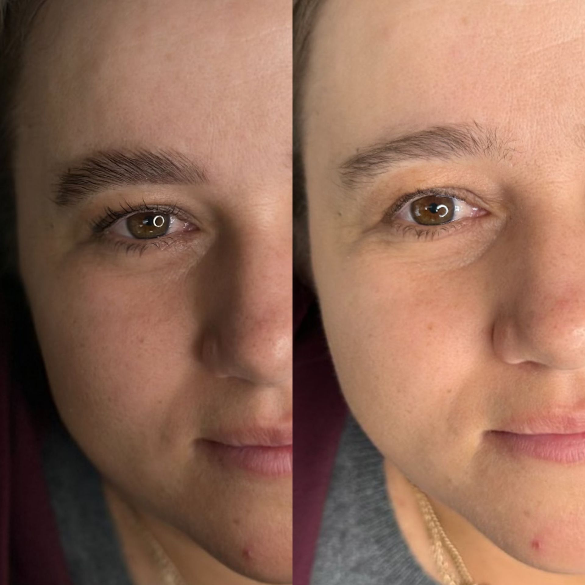 A before and after picture of a woman 's face