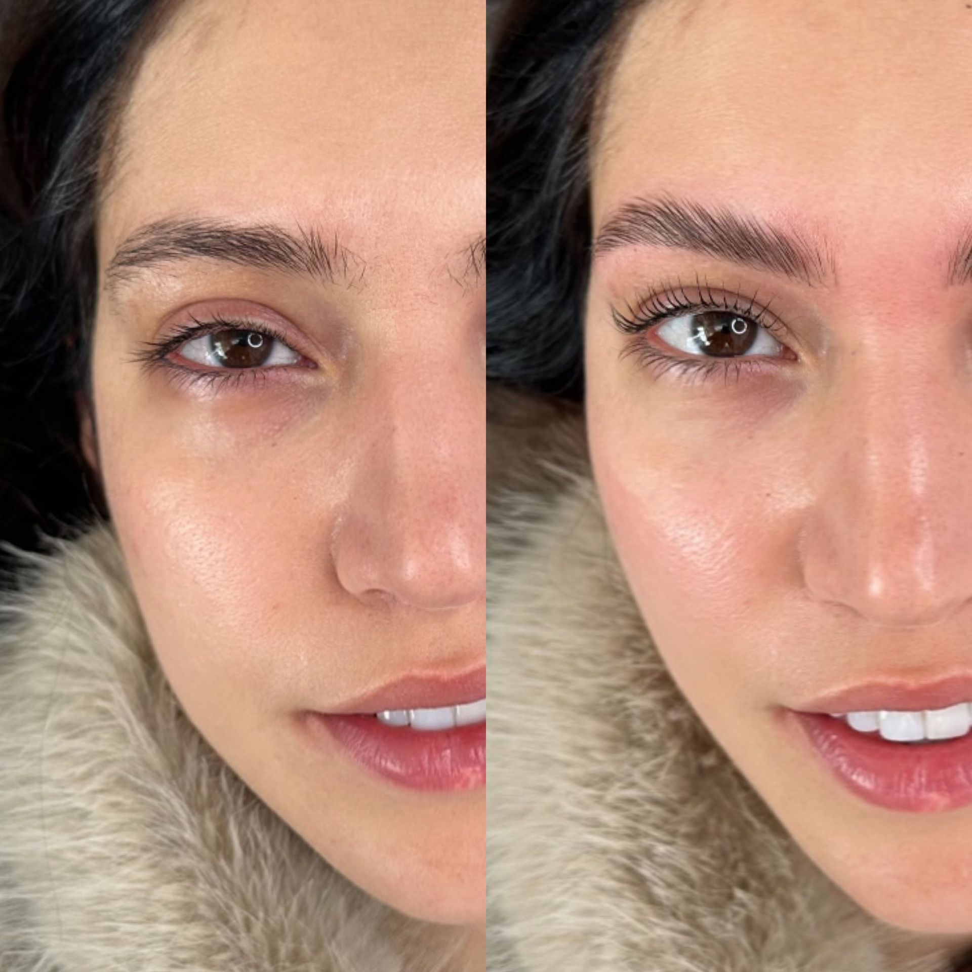 A before and after picture of a woman 's face