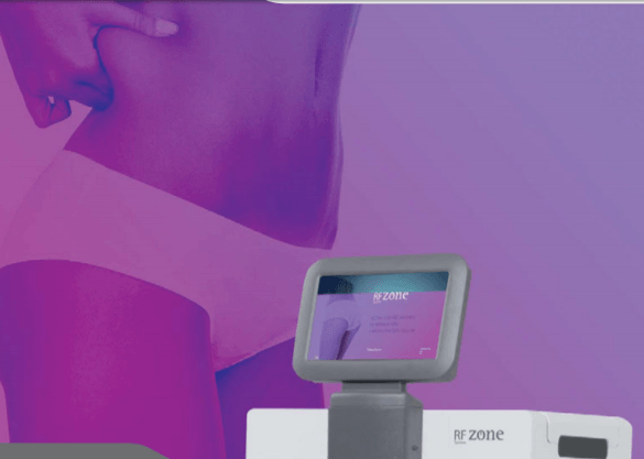 RF Zone bestrijdt cellulite