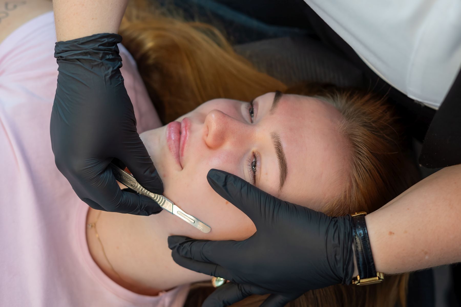 Upgrades - Losse Behandelingen - Derma Planing