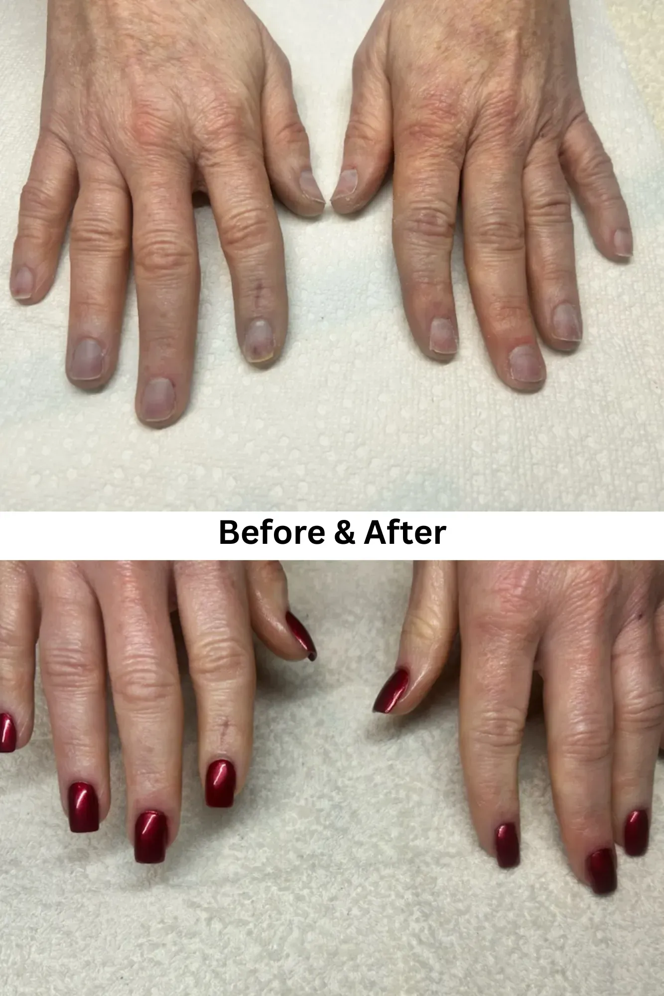 Before and After Acrylic Nail Restoration