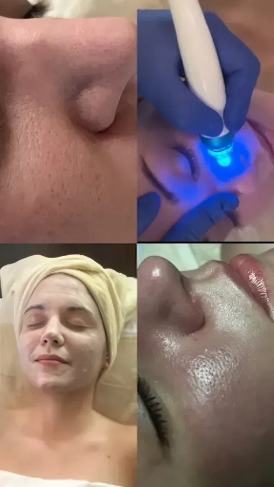 A collage showing a person receiving a facial treatment.