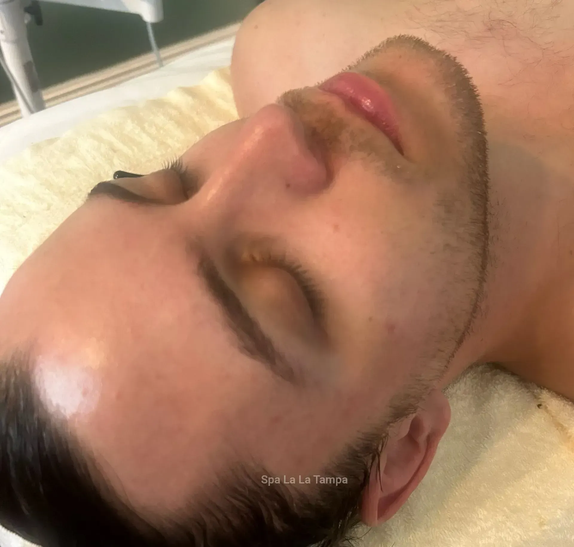 Man with short brown beard and closed eyes, receiving facial treatment. 