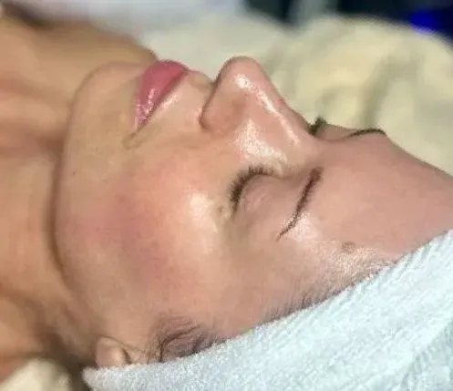 Woman's face close-up, eyes closed, possibly after a facial.
