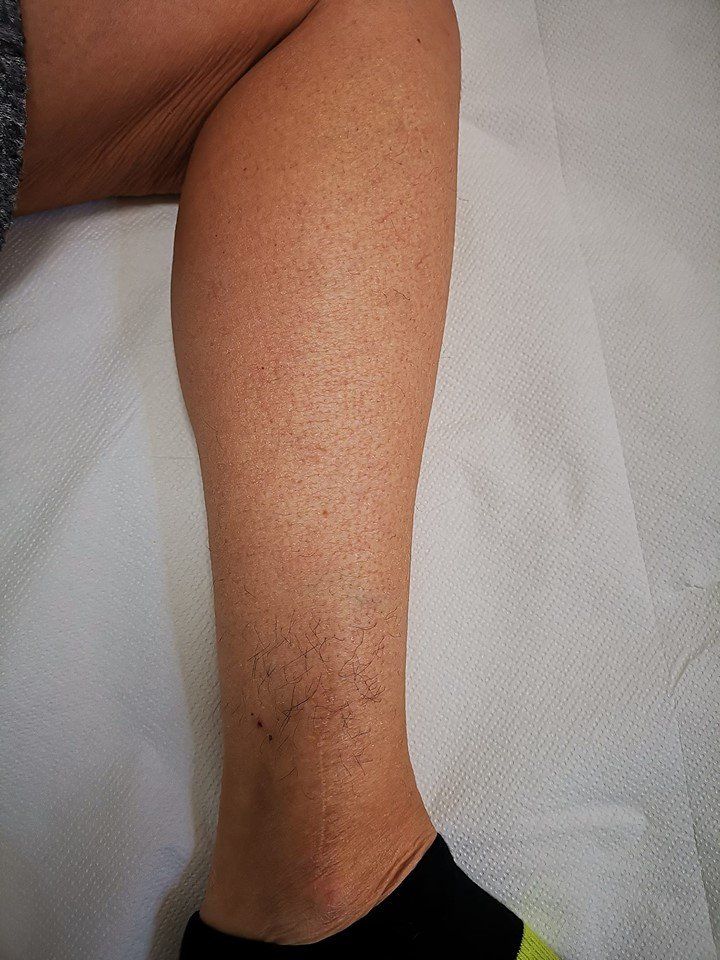 Cliente pronta per un trattamento di epilazione