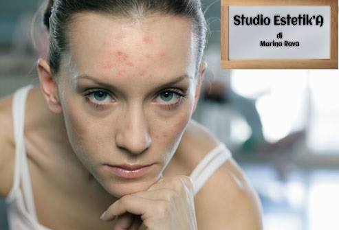 Inestetismi sulla pelle del viso