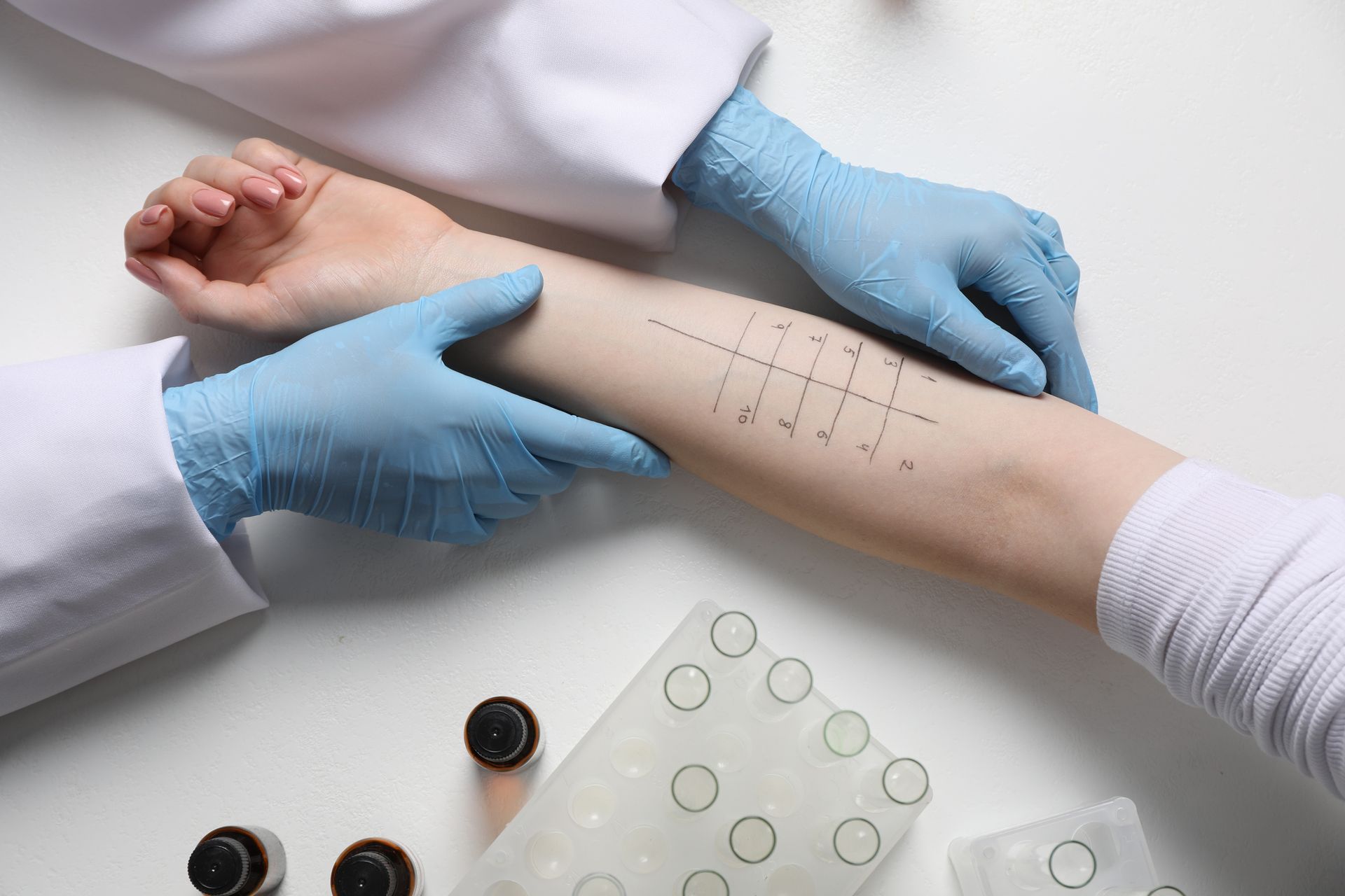 Doctor doing skin allergy test at light table Doctor doing skin allergy test at light table
