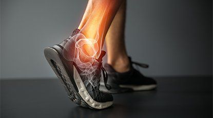 Ankle Pain — Ankle Pain Illustration in Petoskey, MI