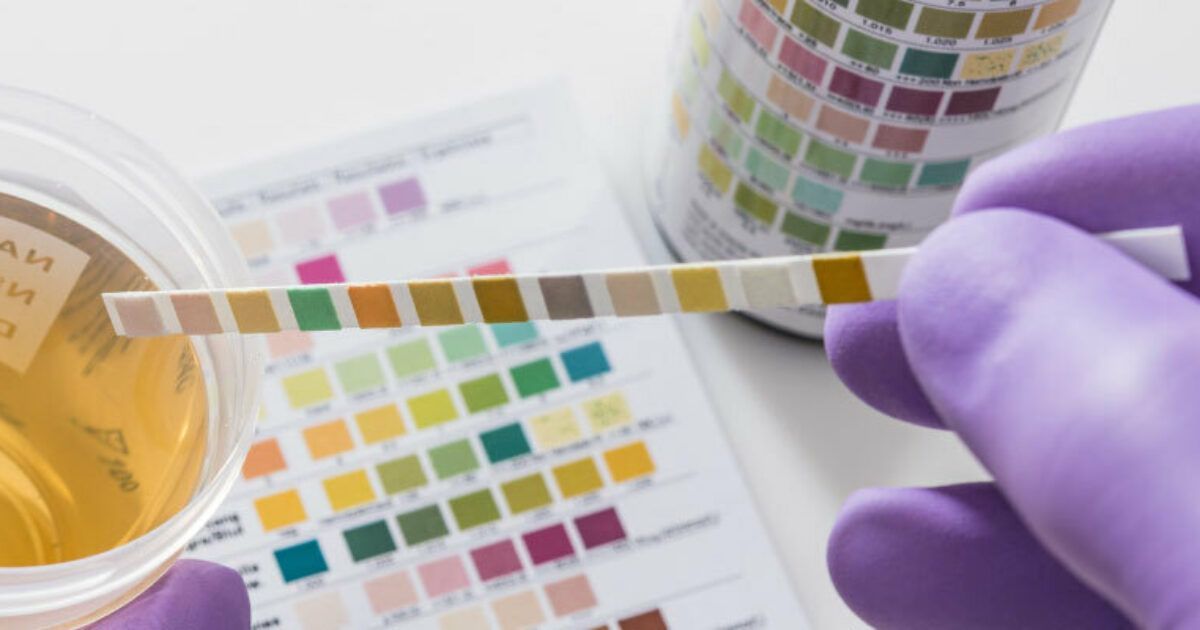 Testing urine samples for a Northwest Arkansas business