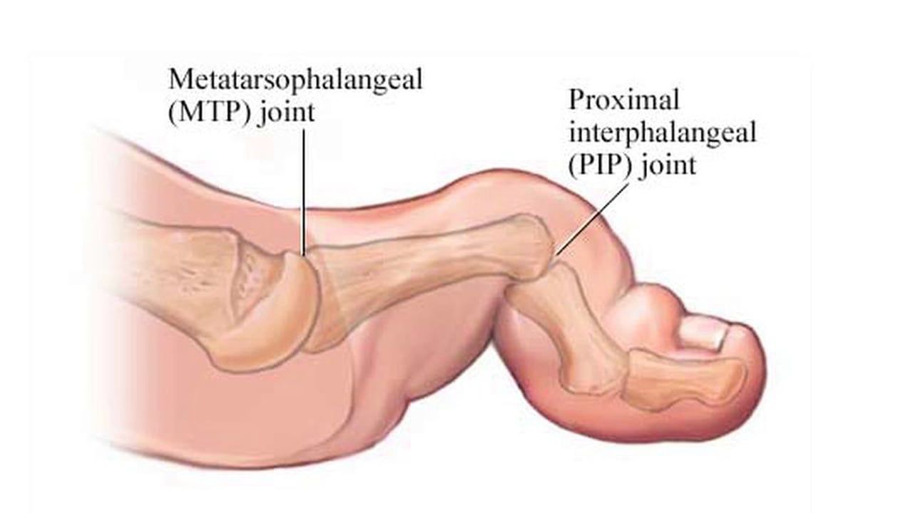foot pain tampa