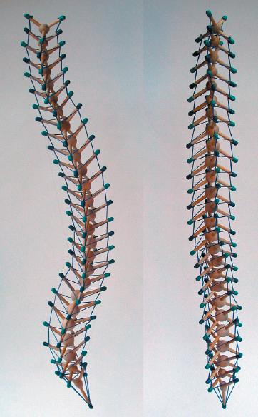 scoliosis treatment st peterburg
