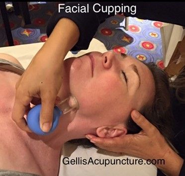 Facial Cupping | Maryville, TN | Inspirational Medicine