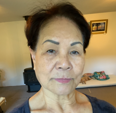 After Treatment — Vancouver, BC — Iki Total Body Care