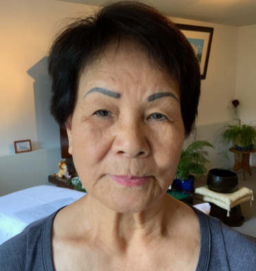 Before Treatment — Vancouver, BC — Iki Total Body Care