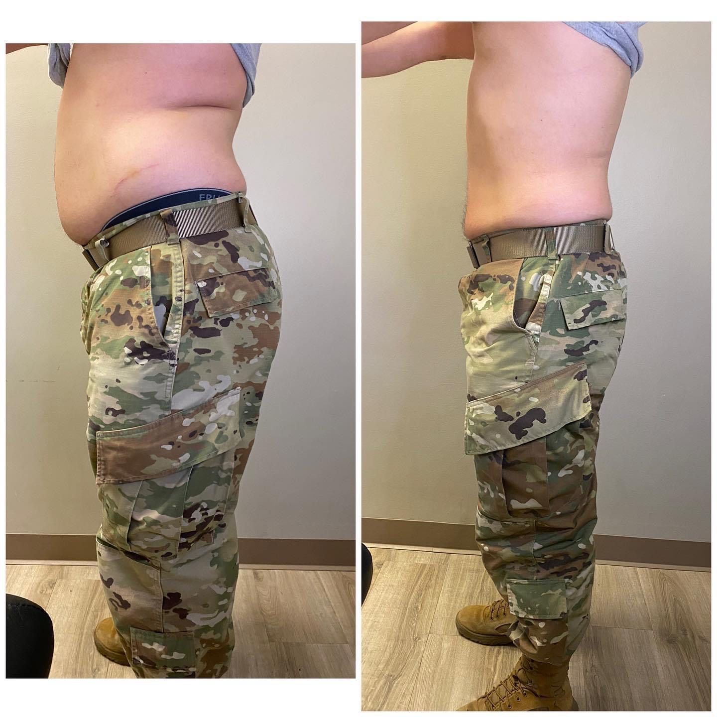 Before-and-after view of a person, showing weight loss. Left side: fuller figure . Right side: slimmer figure, same pants.
