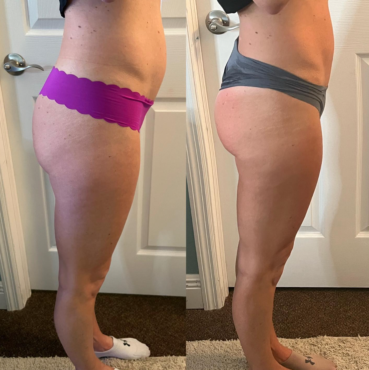 Two side-view photos of a woman in underwear, before and after a body change.