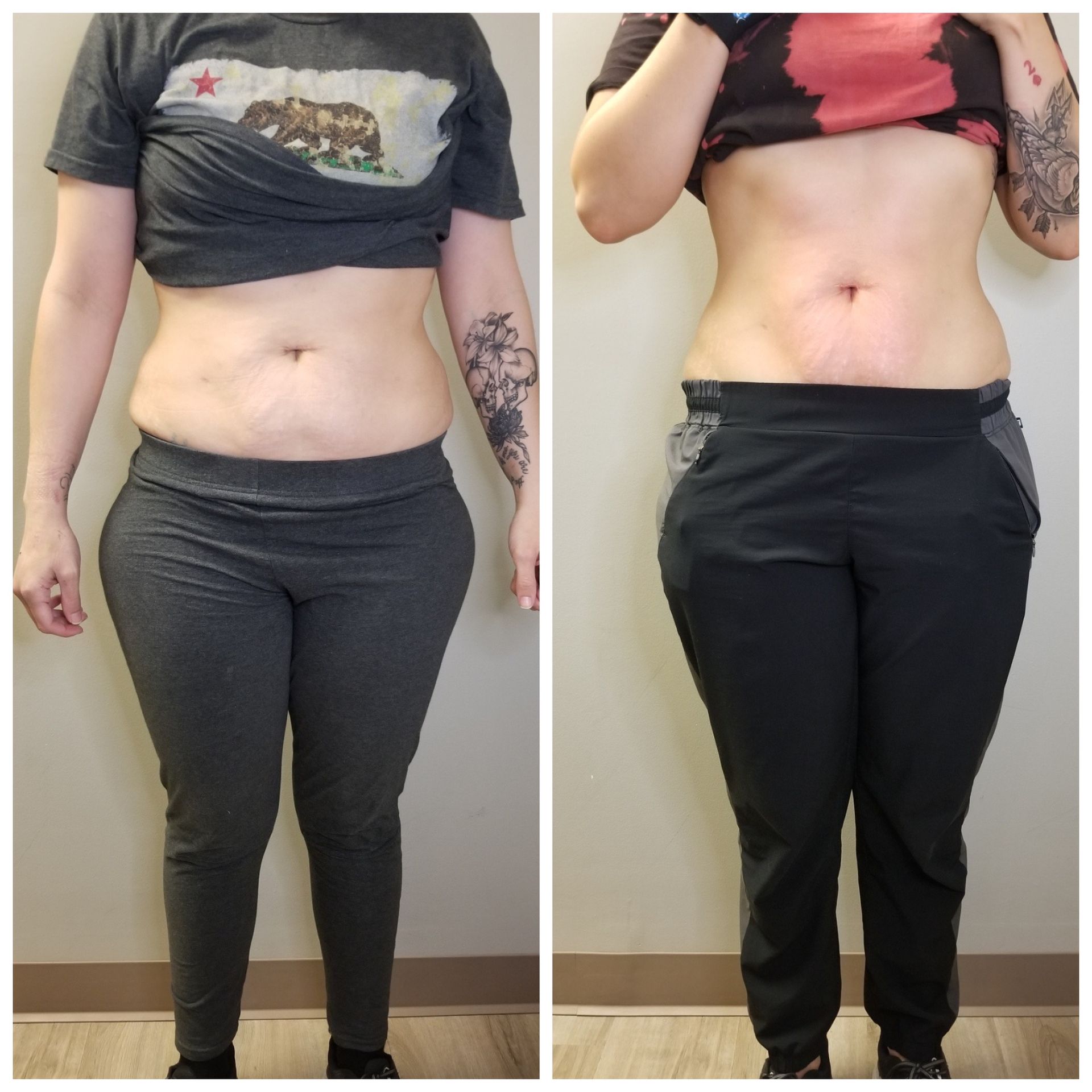Woman standing frontally, before and after photos, showing weight loss in torso and legs, wearing gray workout clothing.