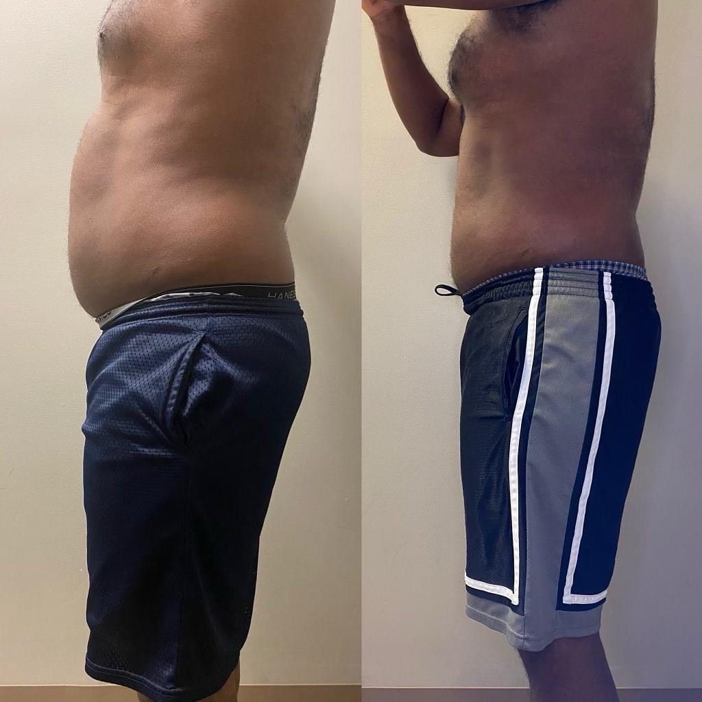Side-by-side comparison of a man's torso before and after weight loss. He is wearing shorts in both photos.