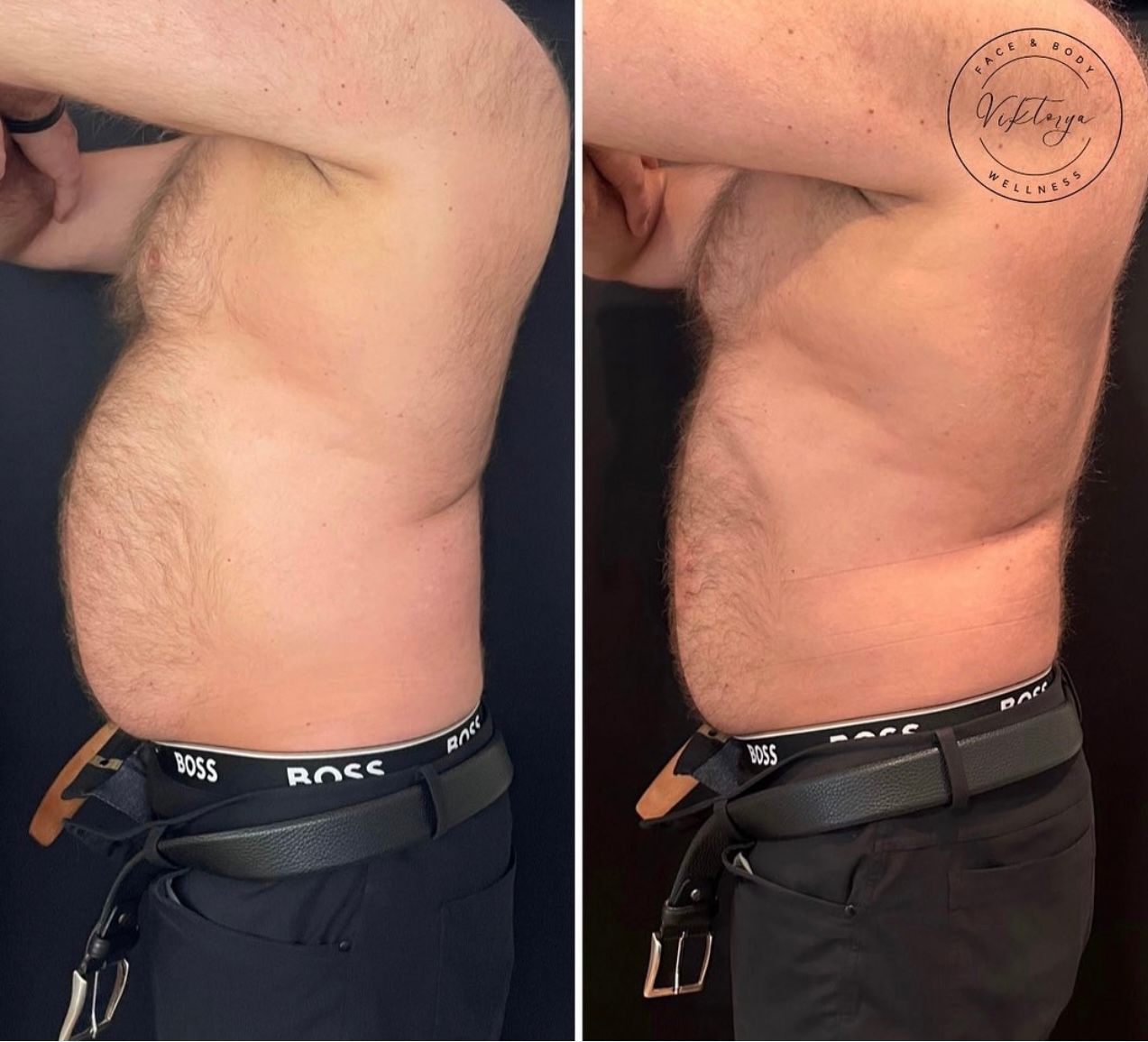 Before-and-after photos of a man's torso, showing reduced belly fat. He wears dark pants and a belt.