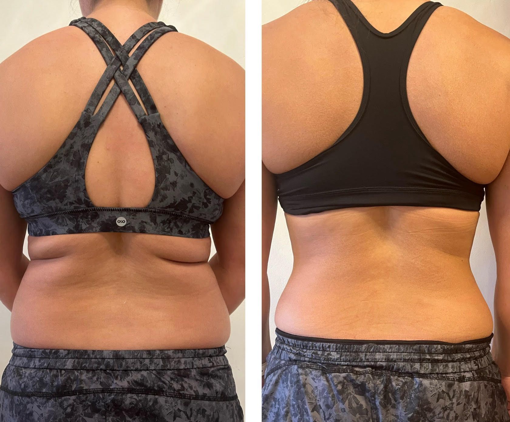 Side-by-side photos of a person's back, before and after weight loss, wearing sports bras and shorts.