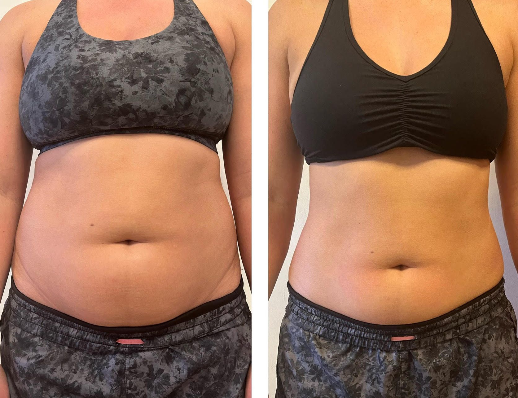 Woman in sports bra, before and after weight loss; showing reduced belly fat.