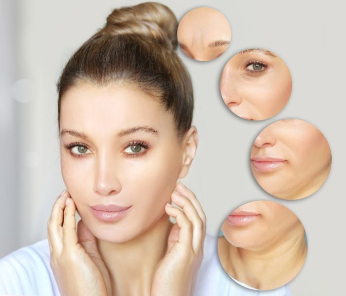 Woman's face, close-up with circled close-ups of wrinkles on forehead, eye area, lips, and chin.