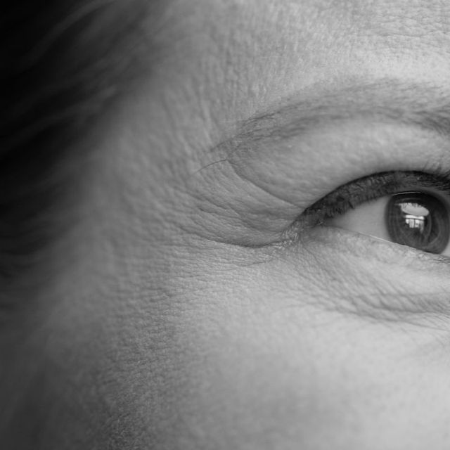 Softening facial wrinkles from aging