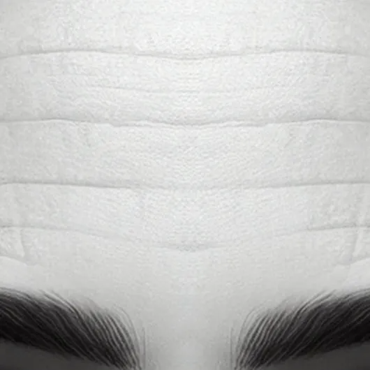 Forehead Lines