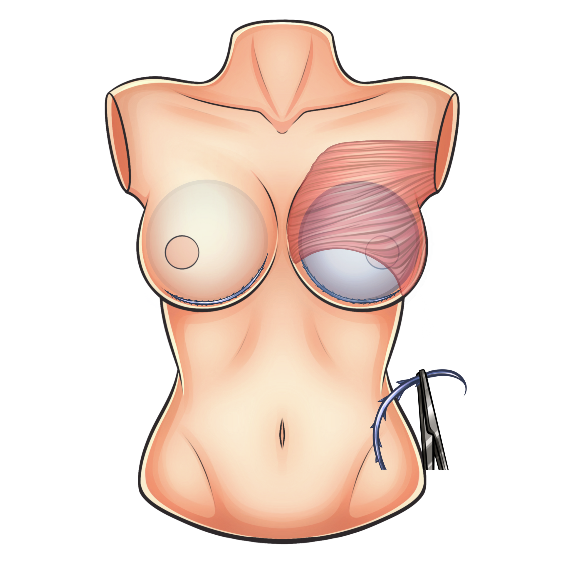 Um desenho do torso de uma mulher com uma agulha nele.