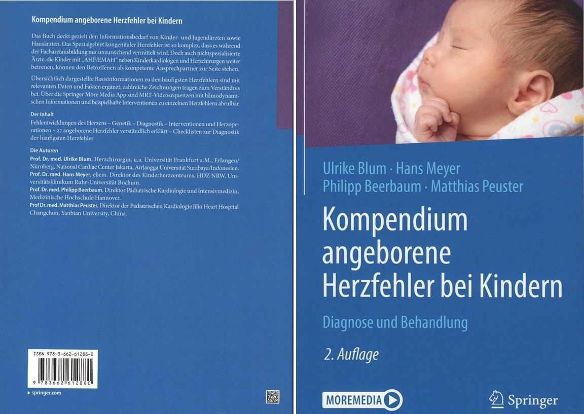 Angeborene Herzfehler 2. Ausgabe