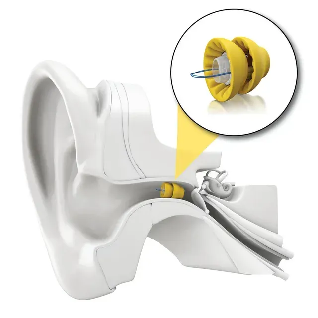 A white ear with a pair of yellow ear plugs
