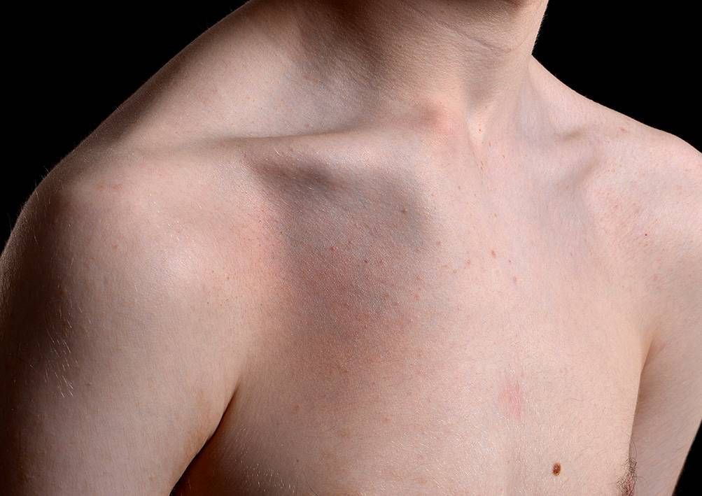 Um close do peito e do ombro de um homem.