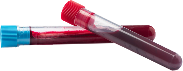 Two test tubes filled with blood, one with a red cap, the other with a blue cap.