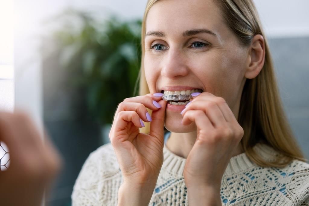 The Benefits of Invisalign® Clear Aligners in Leesburg : Loudoun Family and Cosmetic Densistry