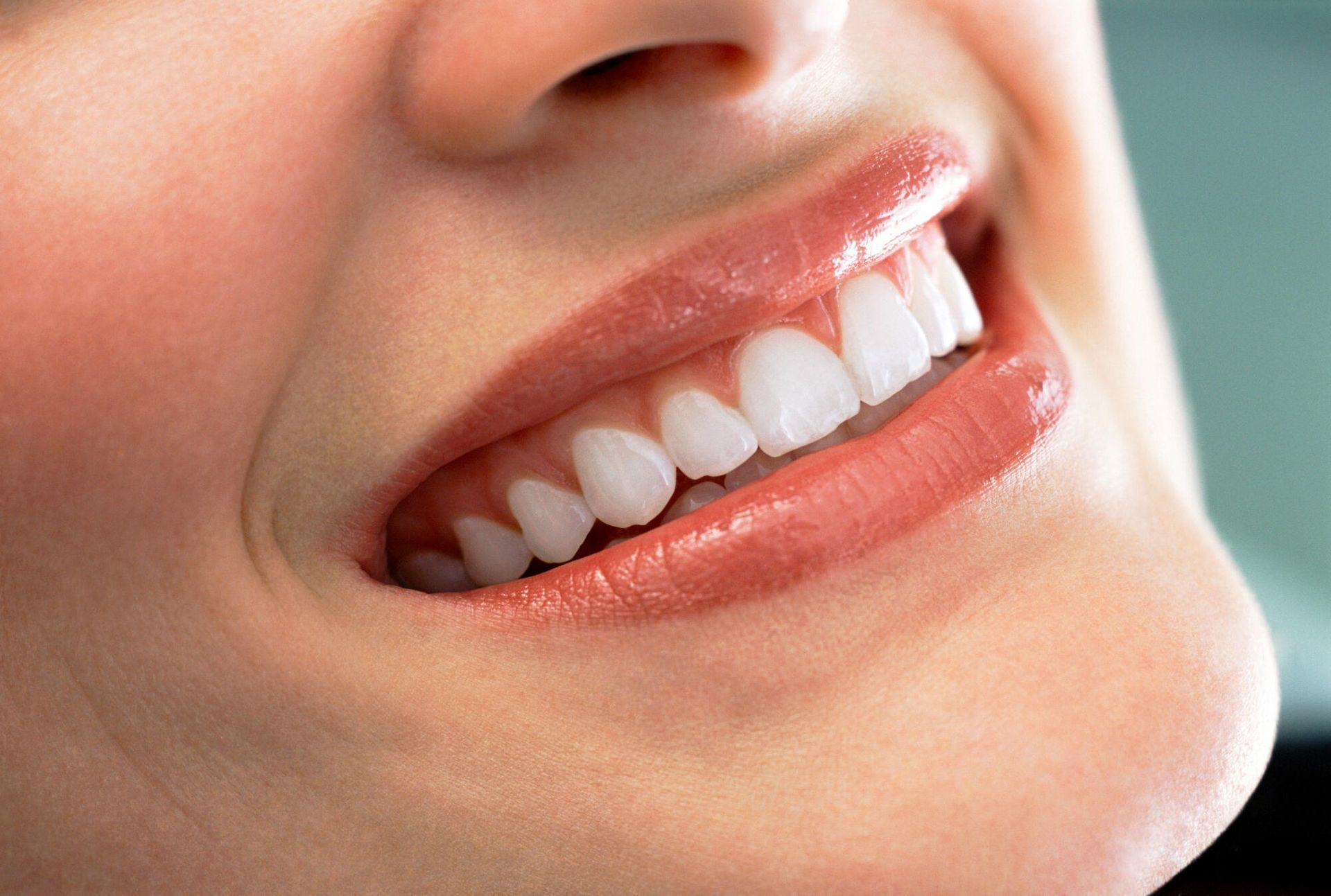 A close up of a woman 's smile with white teeth.